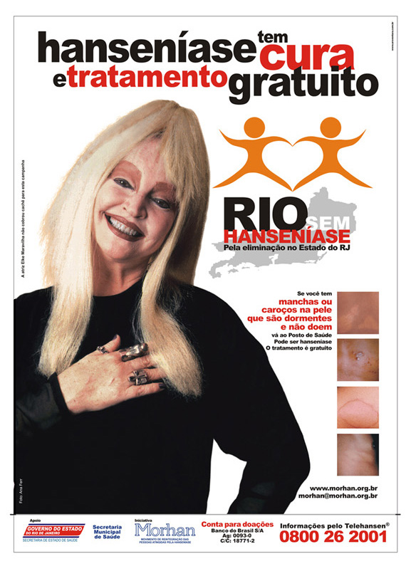   Elke Maravilha  em cartaz da campanha de combate &agrave; hansen&iacute;ase no Rio de Janeiro
